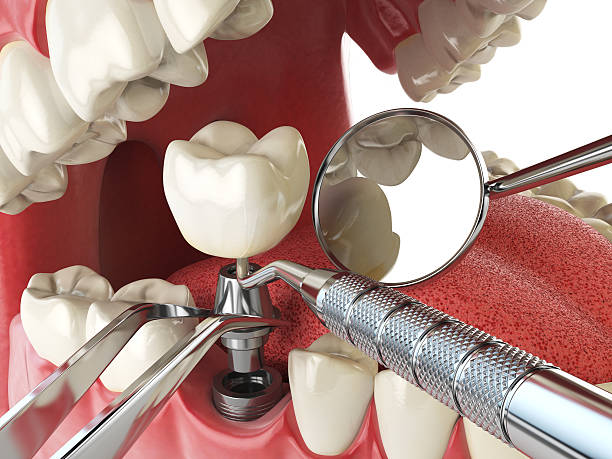 Best Emergency Gum Treatment in Cottage Grove, WI